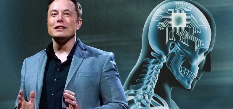 Farsi mettere un chip nel cervello da Musk